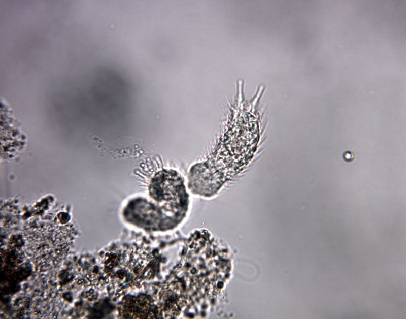 Chaetonotus sp (Gastrotrico)